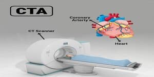 Een CT-scanner met een patiënt erin en een anatomisch model van een hart met de kransslagaders uitgelicht, naast de tekst 'CTA'.
